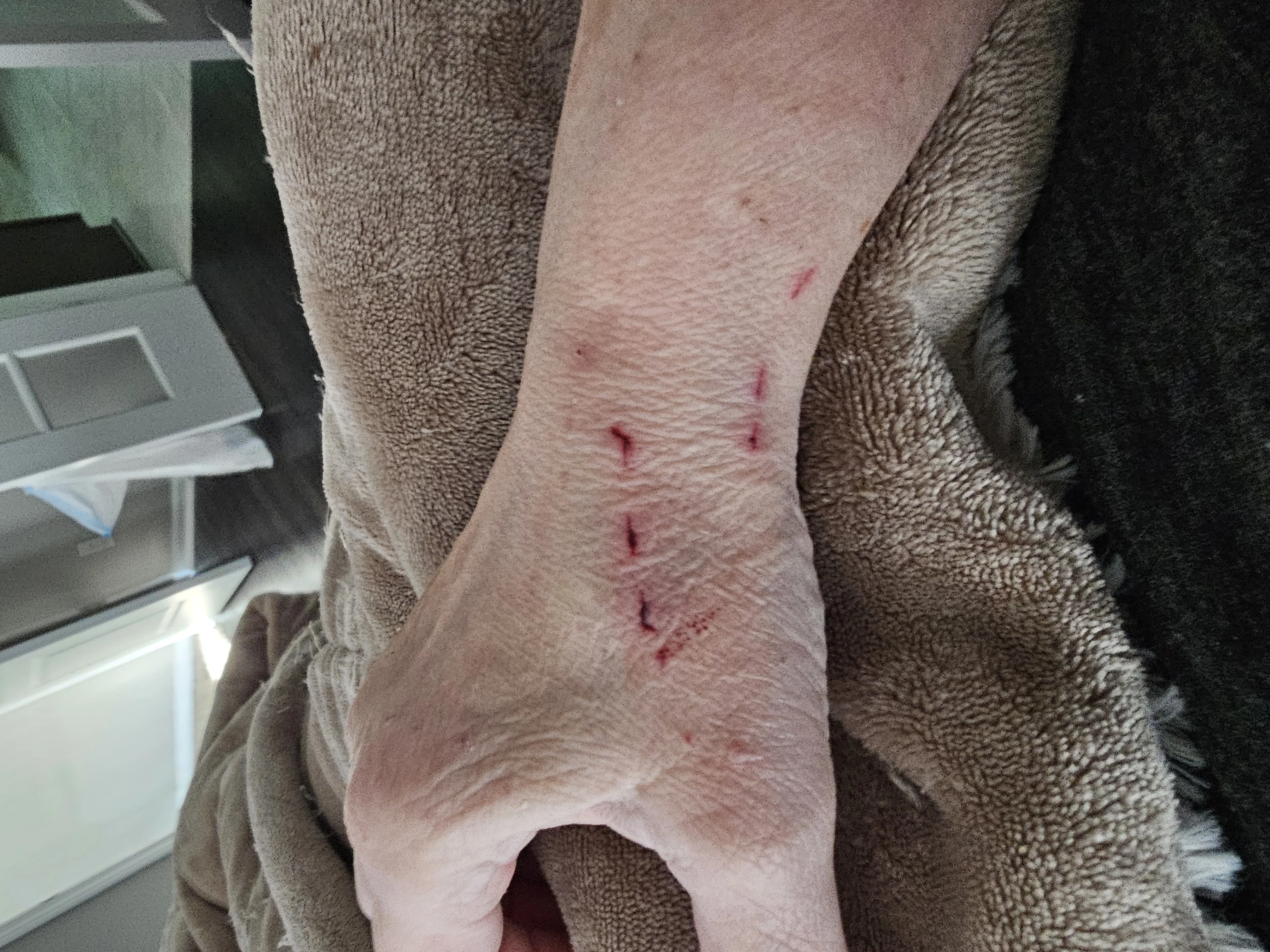 The wounds — documented evidence of Dallas's objections